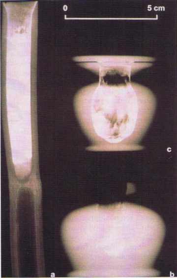 Radiographie de flacon de fard égyptien