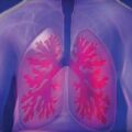 Modélisation du poumon pour traiter les insuffisances respiratoires