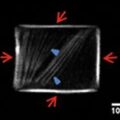 Image en fluorescence d’une cellule U2OS RFP-LifeAct