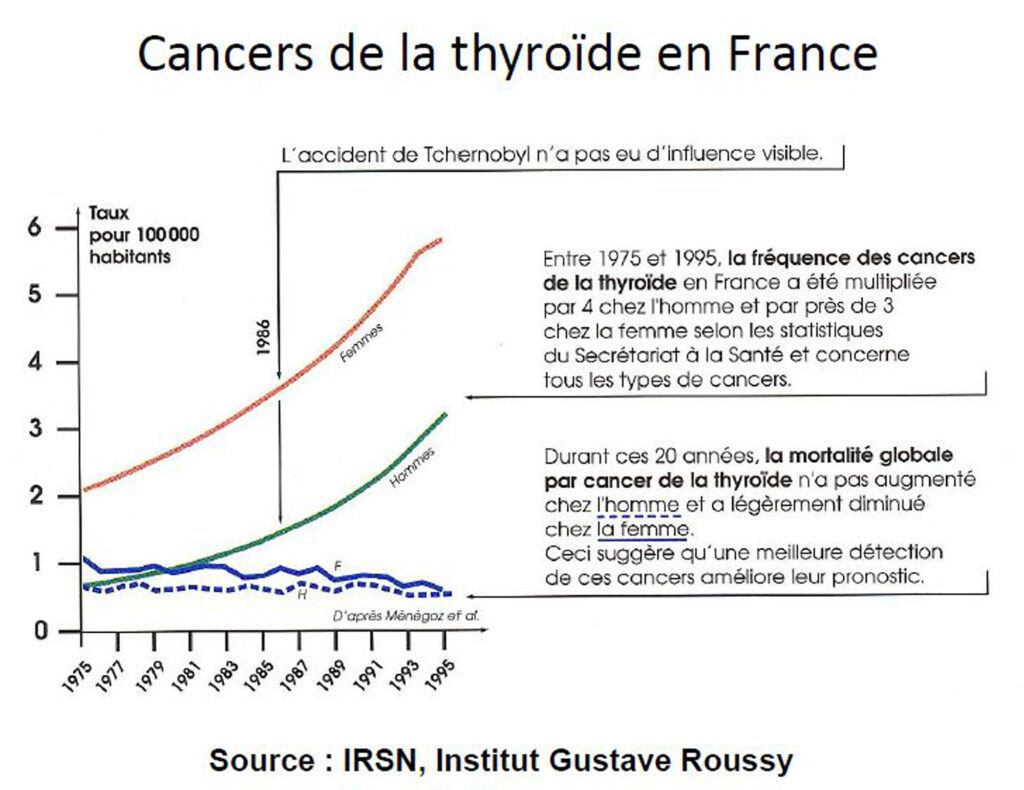 Influence de l'accident de Tchernobyl sur les cancers de la thyroïde en France