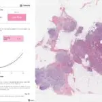 Owkin : L’IA et la data au service de la recherche en oncologie